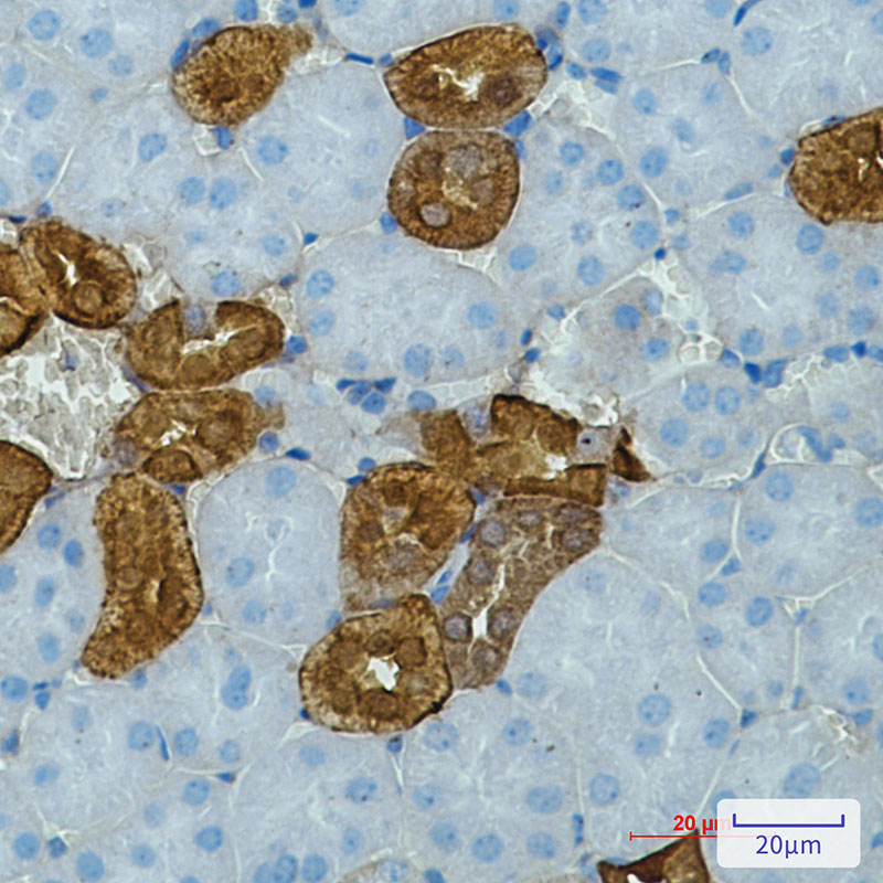 Calbindin Rabbit mAb ABZ2862