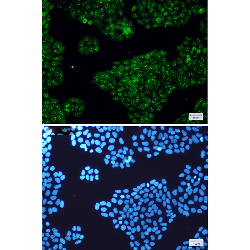 Calretinin Rabbit mAb ABZ2863
