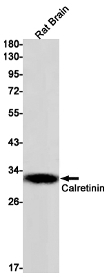 Calretinin Rabbit mAb ABZ2863