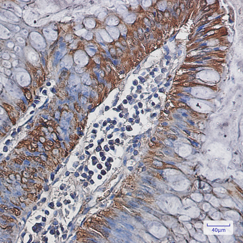Carbonic Anhydrase 1 Rabbit mAb ABZ2864