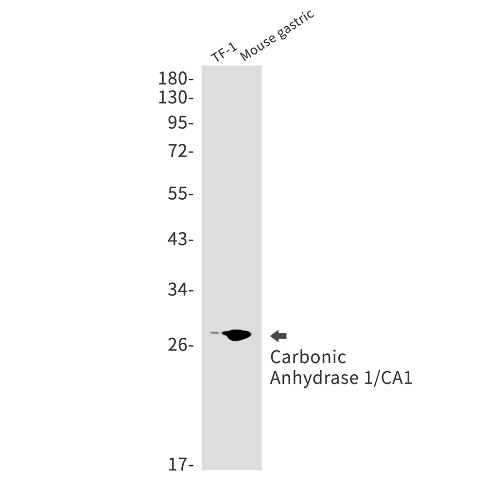 Carbonic Anhydrase 1 Rabbit mAb ABZ2864