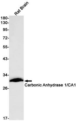 Carbonic Anhydrase 1 Rabbit mAb ABZ2864