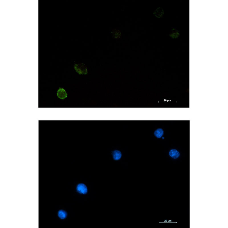 CBL Rabbit mAb ABZ2865