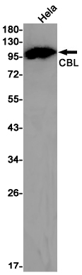 CBL Rabbit mAb ABZ2865