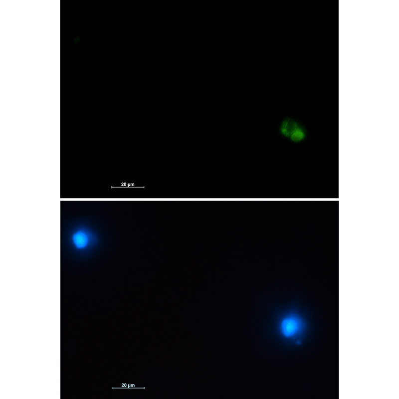 CD22 Rabbit mAb ABZ2869