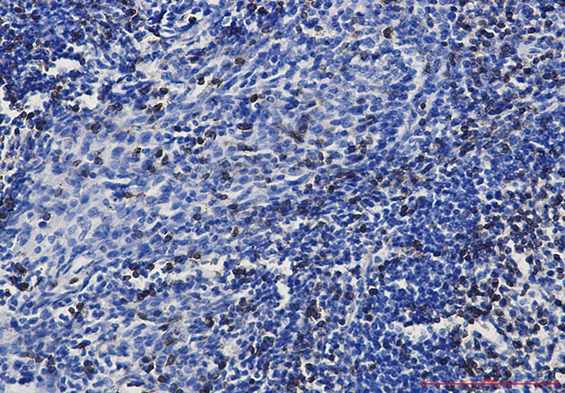 CD3 epsilon Rabbit mAb ABZ2870