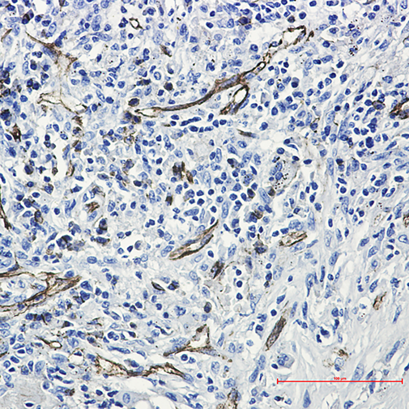 CD31 Rabbit mAb ABZ2871