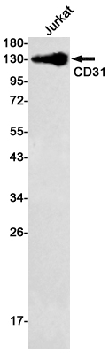CD31 Rabbit mAb ABZ2871