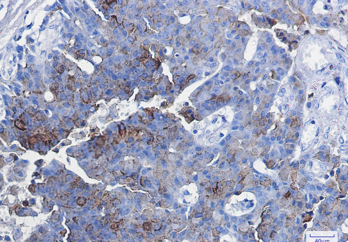 CD63 Rabbit mAb ABZ2878