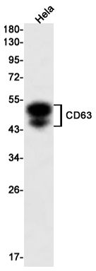 CD63 Rabbit mAb ABZ2878