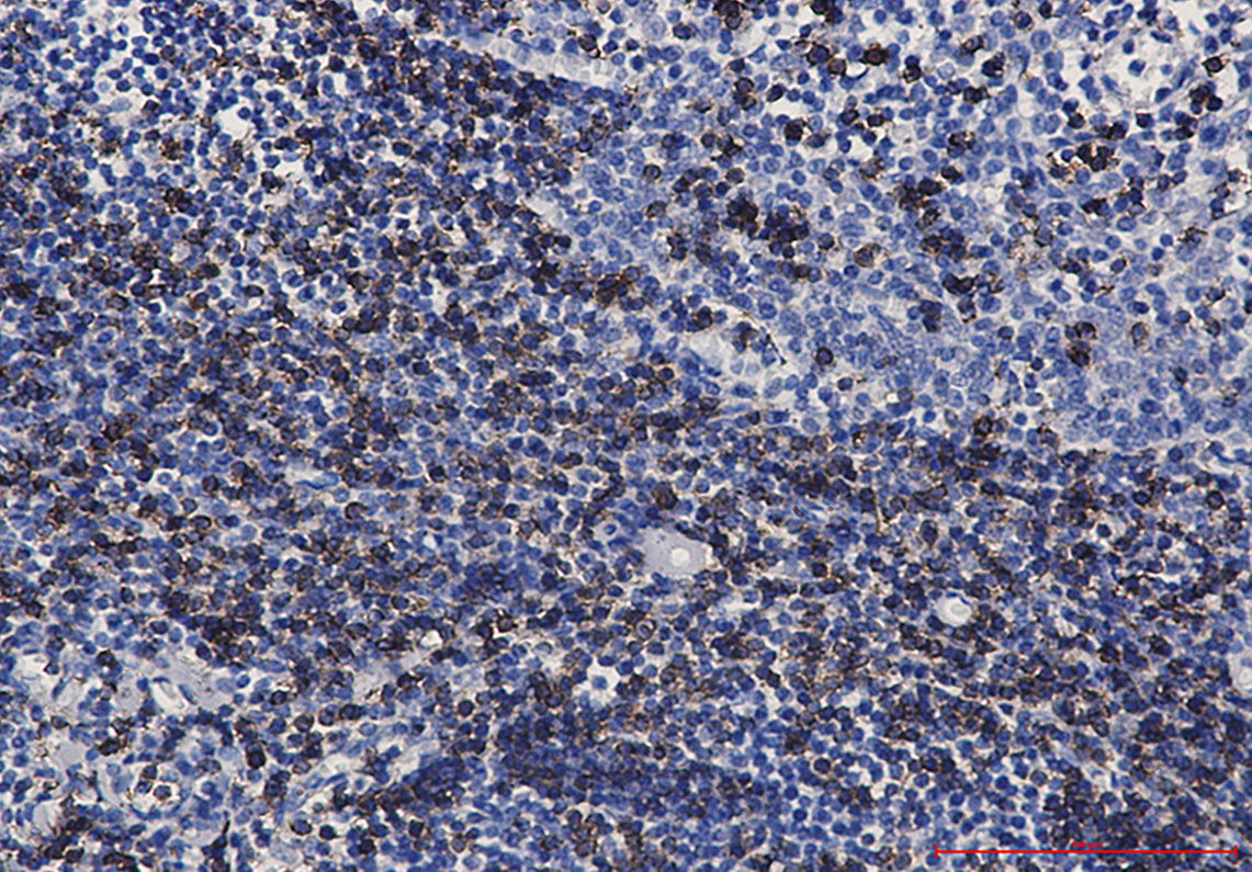 CD7 Rabbit mAb ABZ2879