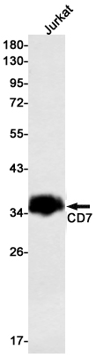 CD7 Rabbit mAb ABZ2879