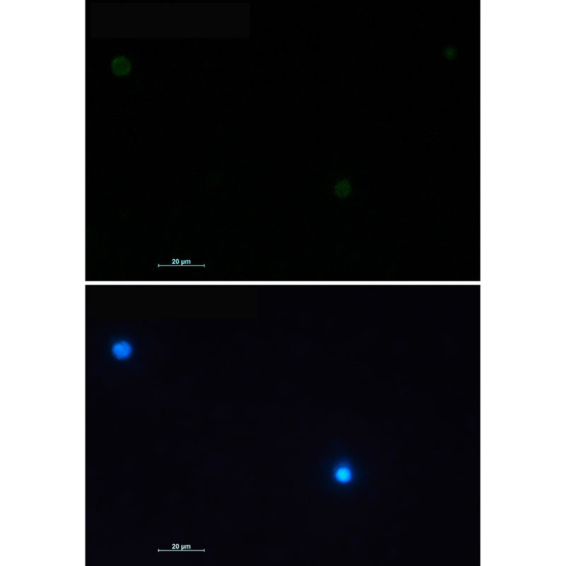 CD79a Rabbit mAb ABZ2880