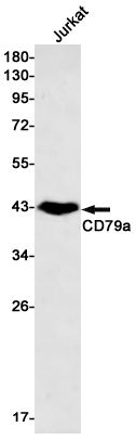 CD79a Rabbit mAb ABZ2880