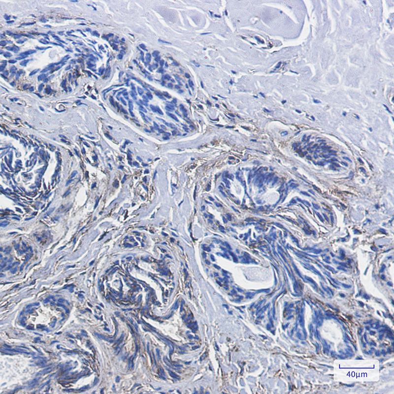 CD99 Rabbit mAb ABZ2881