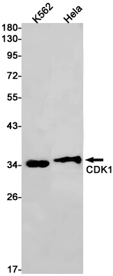 CDK1 Rabbit mAb ABZ2884