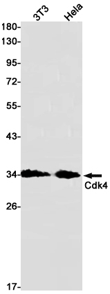 CDK4 Rabbit mAb ABZ2885