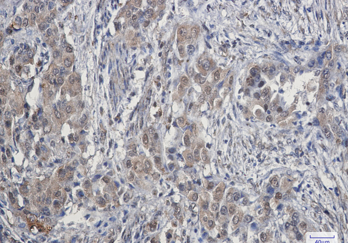 CDK4 Rabbit mAb ABZ2886