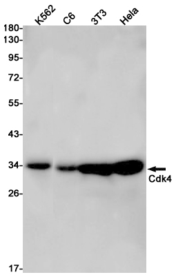 CDK4 Rabbit mAb ABZ2886