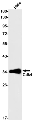 CDK4 Rabbit mAb ABZ2887