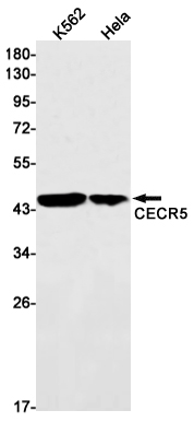 CECR5 Rabbit mAb ABZ2888
