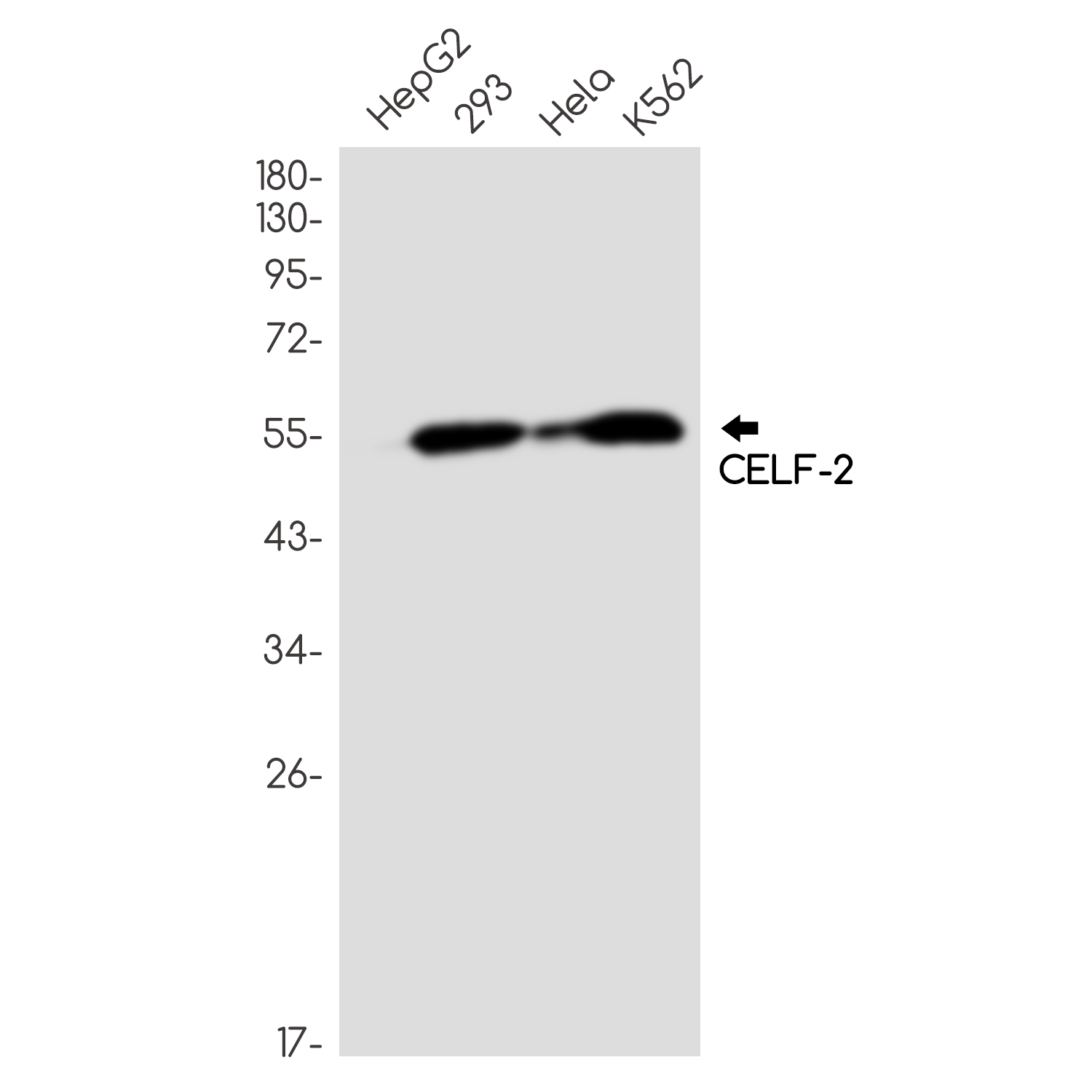 CELF2 Rabbit mAb ABZ2889