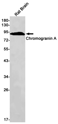 Chromogranin A Rabbit mAb ABZ2892