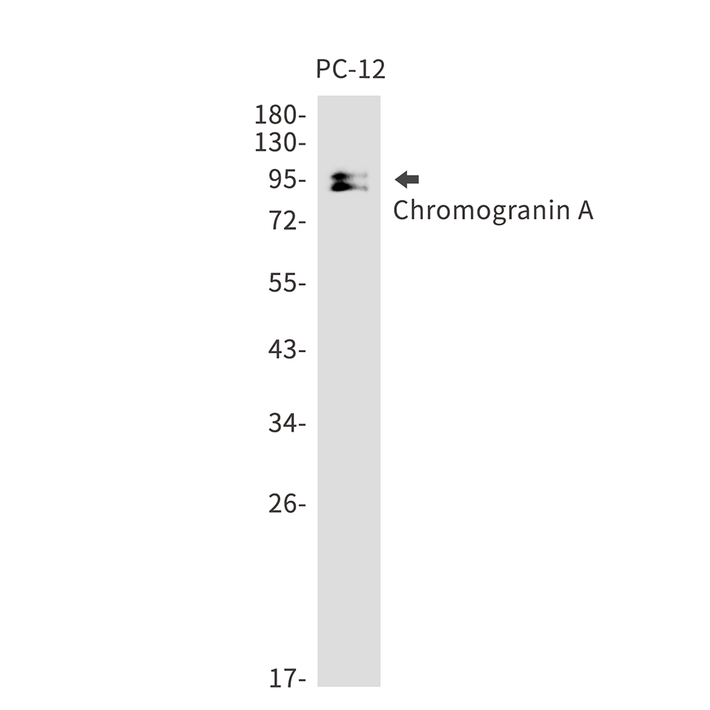 Chromogranin A Rabbit mAb ABZ2893