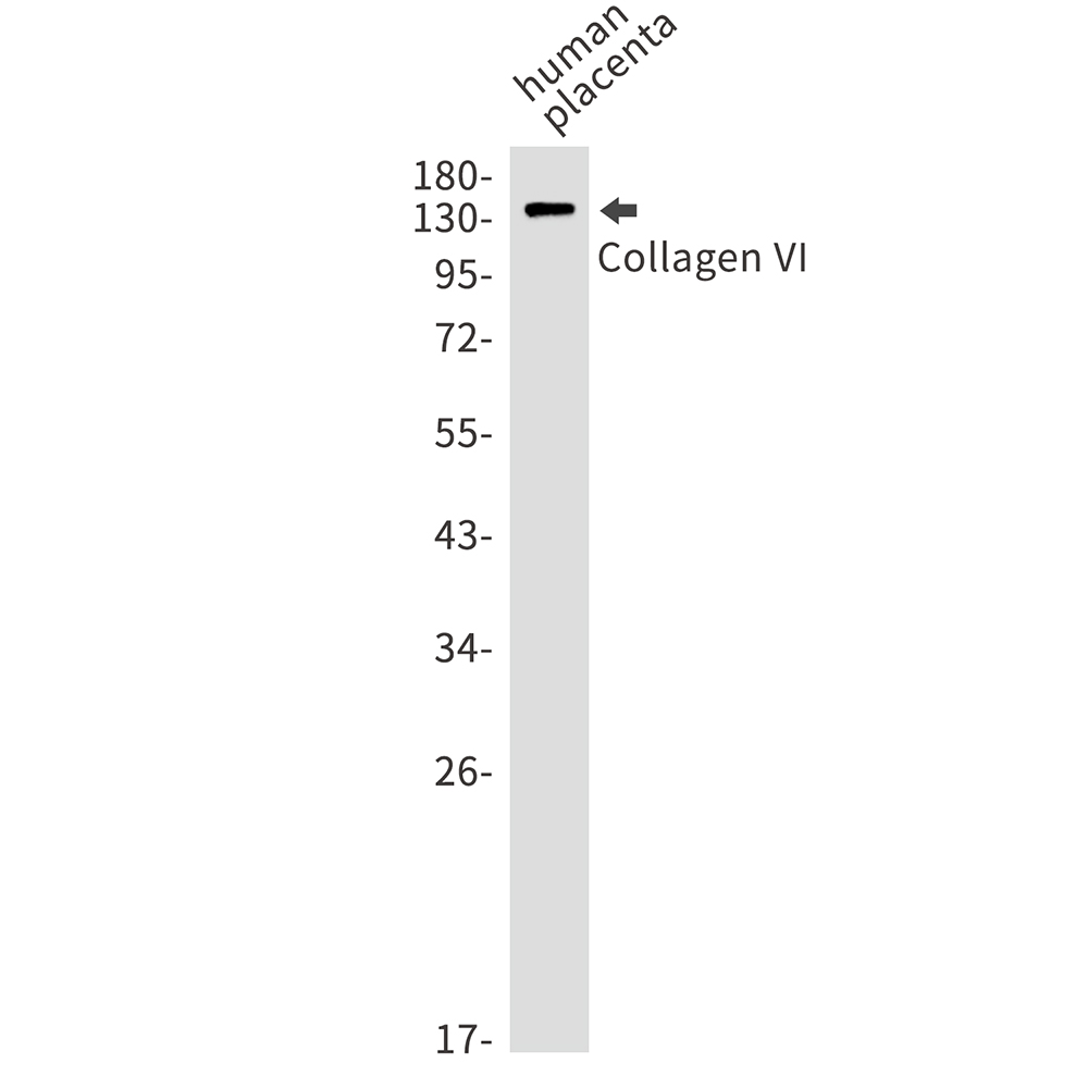 Collagen VI alpha 1 Rabbit mAb ABZ2901