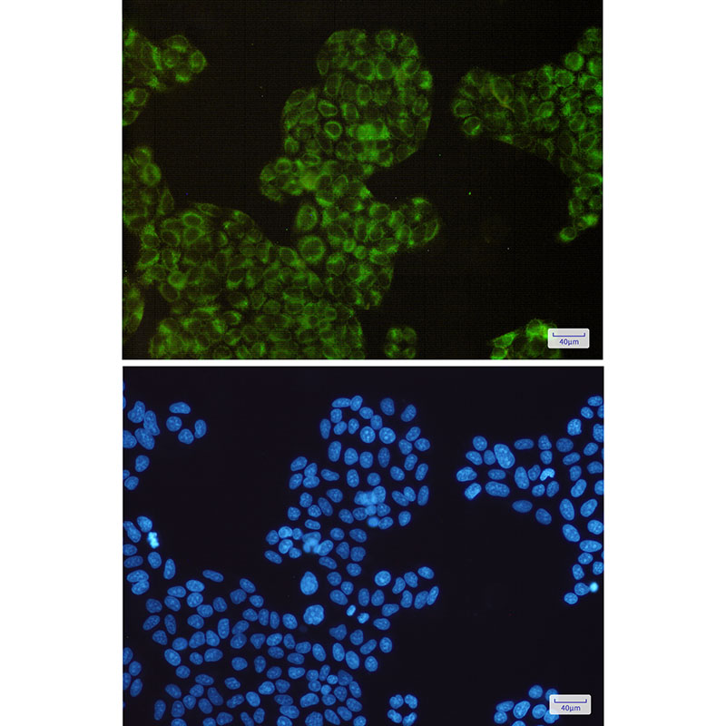 Cyclooxygenase 1 Rabbit mAb ABZ2902