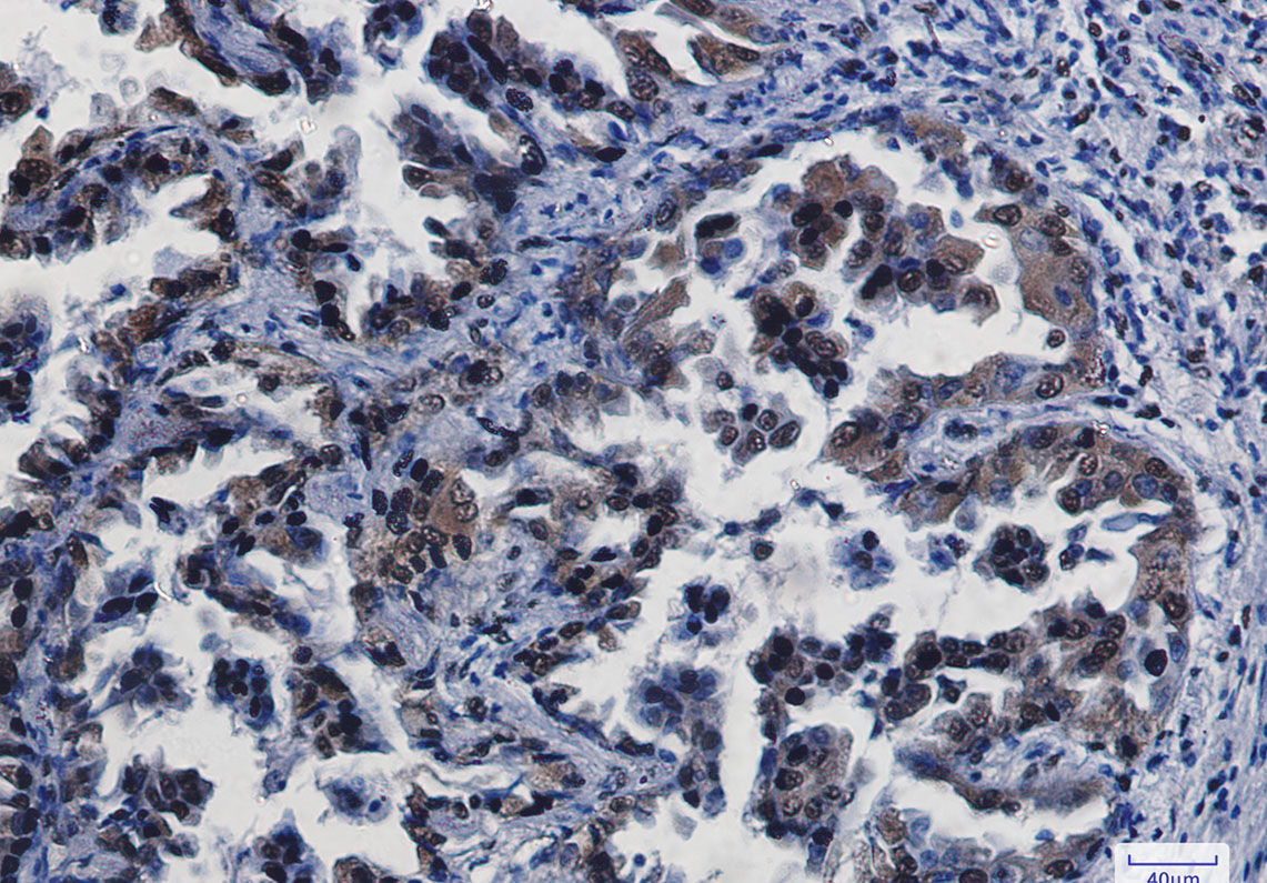CREB Rabbit mAb ABZ2903