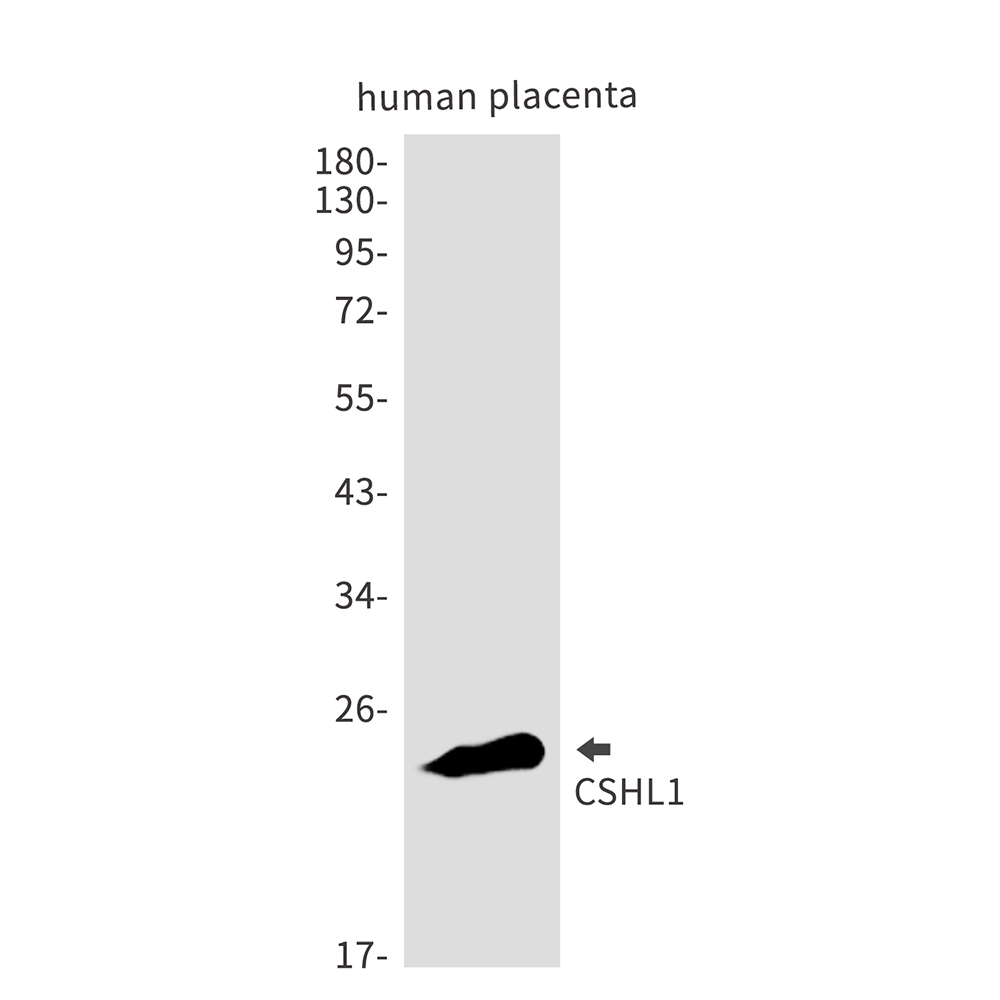 CSHL1 Rabbit mAb ABZ2906