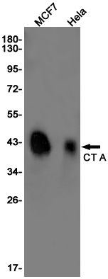 CT A Rabbit mAb ABZ2907