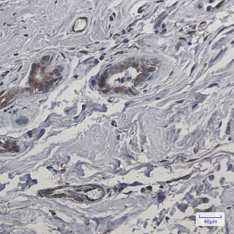CYB5R3 Rabbit mAb ABZ2908