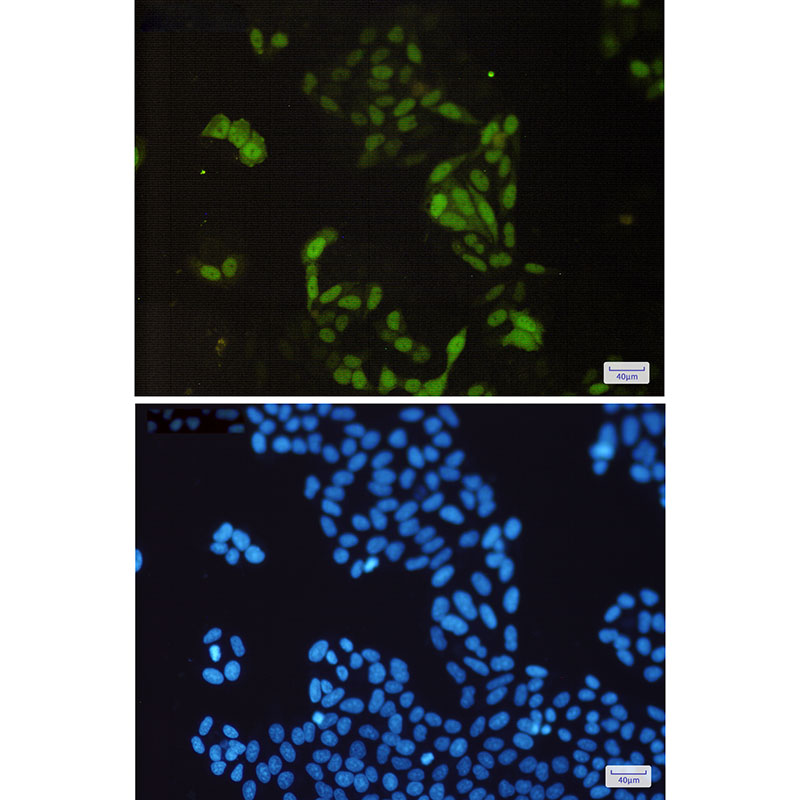 Cyclin A2 Rabbit mAb ABZ2909