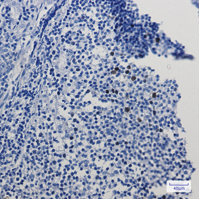 Cyclin A2 Rabbit mAb ABZ2909