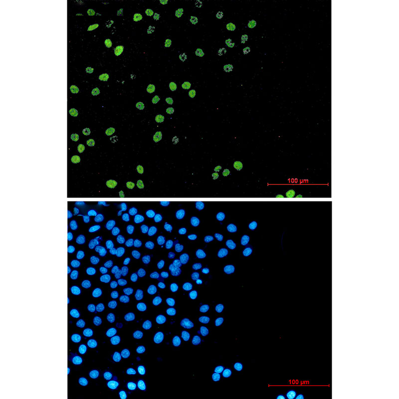 Cyclin A2 Rabbit mAb ABZ2910