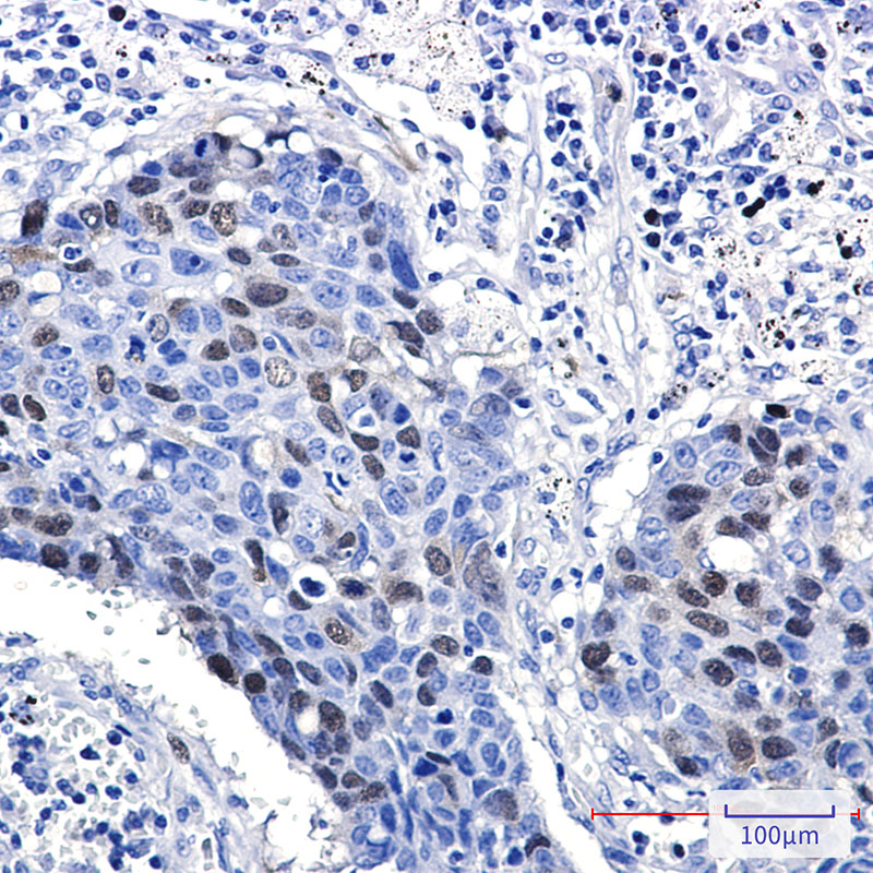Cyclin A2 Rabbit mAb ABZ2910