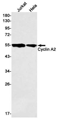 Cyclin A2 Rabbit mAb ABZ2910