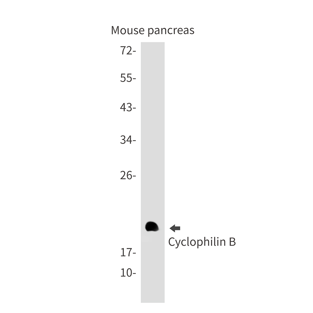 Cyclophilin B Rabbit mAb ABZ2911
