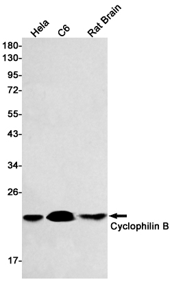 Cyclophilin B Rabbit mAb ABZ2911