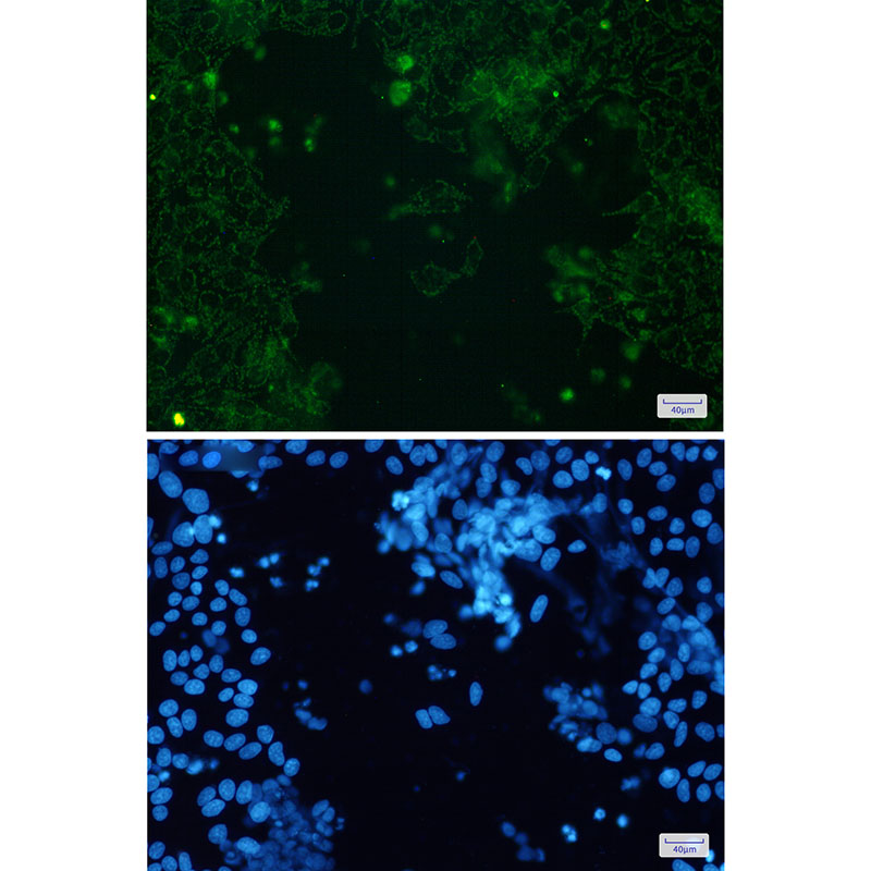 Cytochrome P450 17A1/CYP17A1 Rabbit mAb ABZ2913