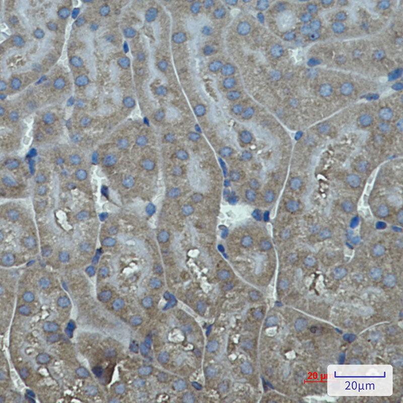 Cytochrome P450 17A1/CYP17A1 Rabbit mAb ABZ2913