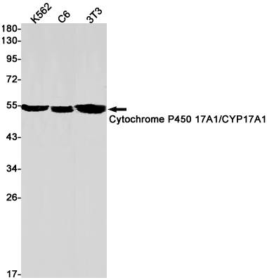 Cytochrome P450 17A1/CYP17A1 Rabbit mAb ABZ2913