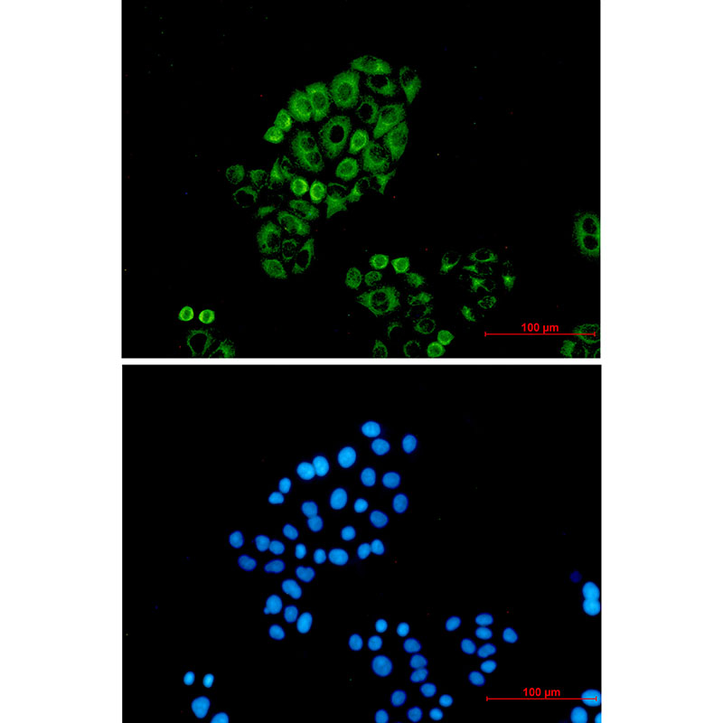 Cytokeratin 18 Rabbit mAb ABZ2914