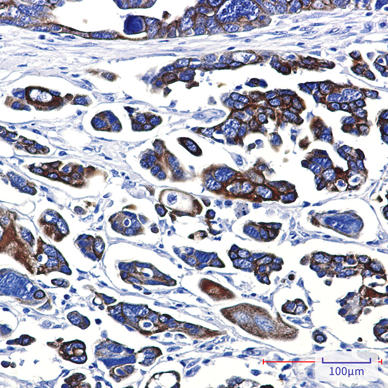 Cytokeratin 18 Rabbit mAb ABZ2914