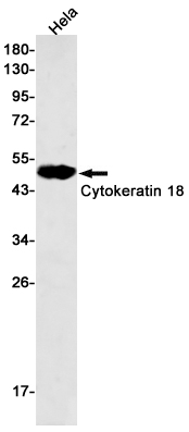 Cytokeratin 18 Rabbit mAb ABZ2914