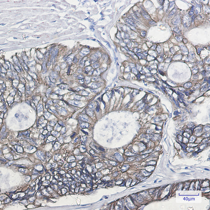 Cytokeratin 19 Rabbit mAb ABZ2915