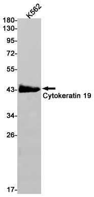 Cytokeratin 19 Rabbit mAb ABZ2915