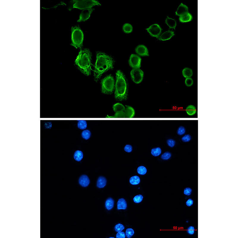 Cytokeratin 19 Rabbit mAb ABZ2916